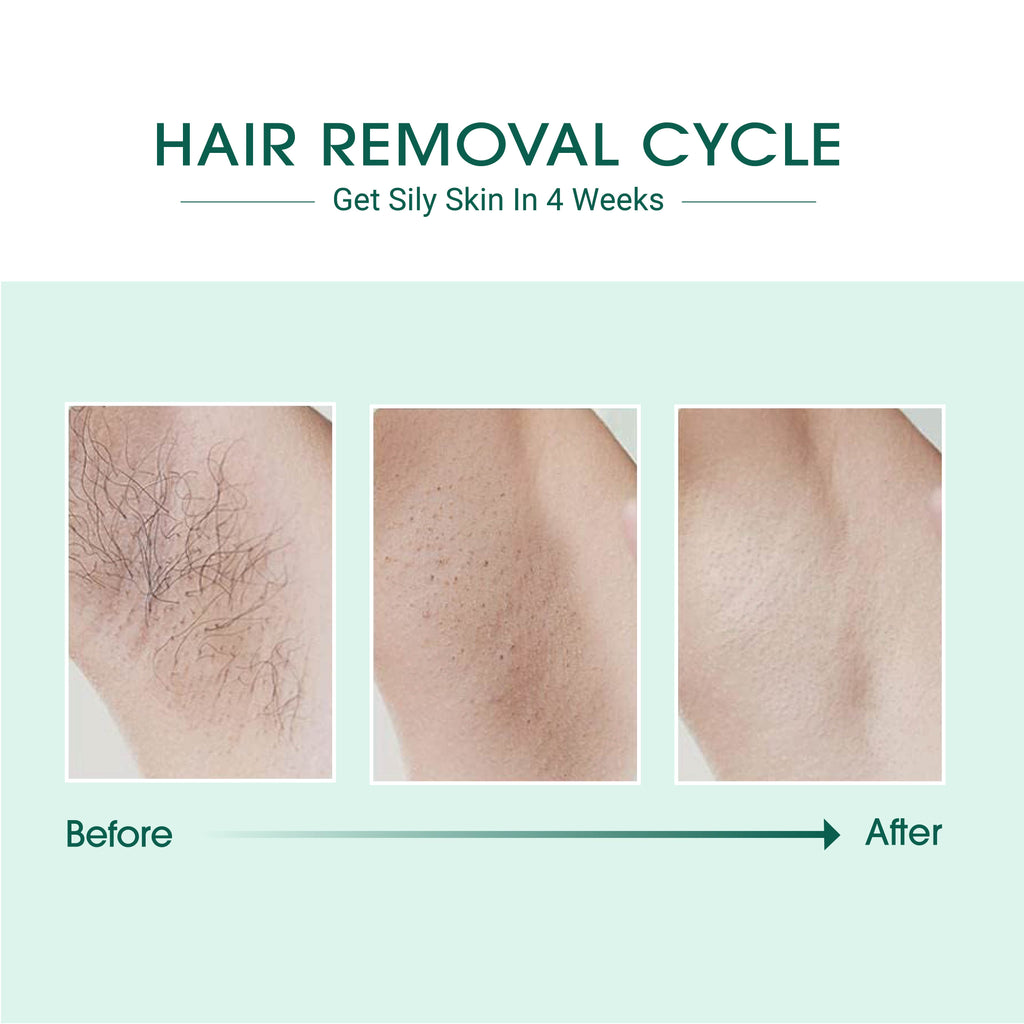 IPL Laser Hair Remover with Air Cooling – Painless, Safe & Effective for All Skin Types
